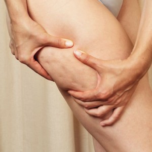 staminaline cellulite 300x300 Staminaline – Crema anticellulite Cadey con cellule staminali