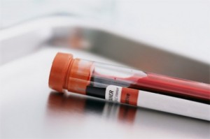 significato esami del sangue