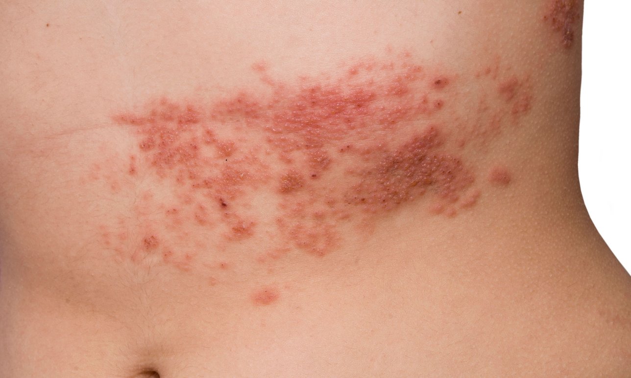 Mezzi per capelli biondi