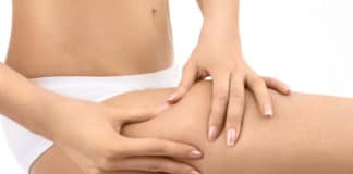 Cellulite