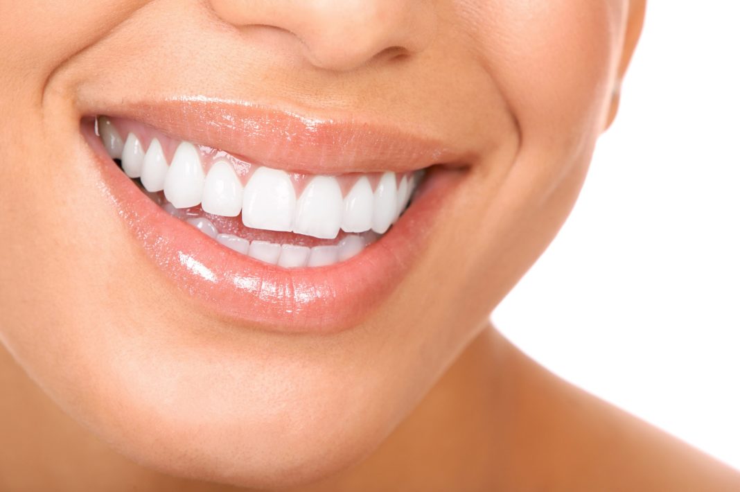 sbiancare denti