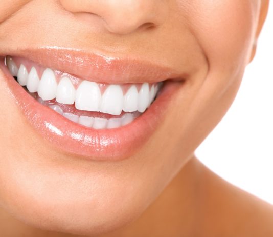 sbiancare denti