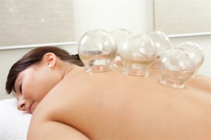 coppettazione cupping