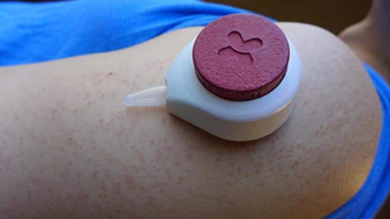 ventosa prelievo sangue
