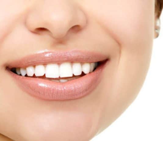 denti bianchi