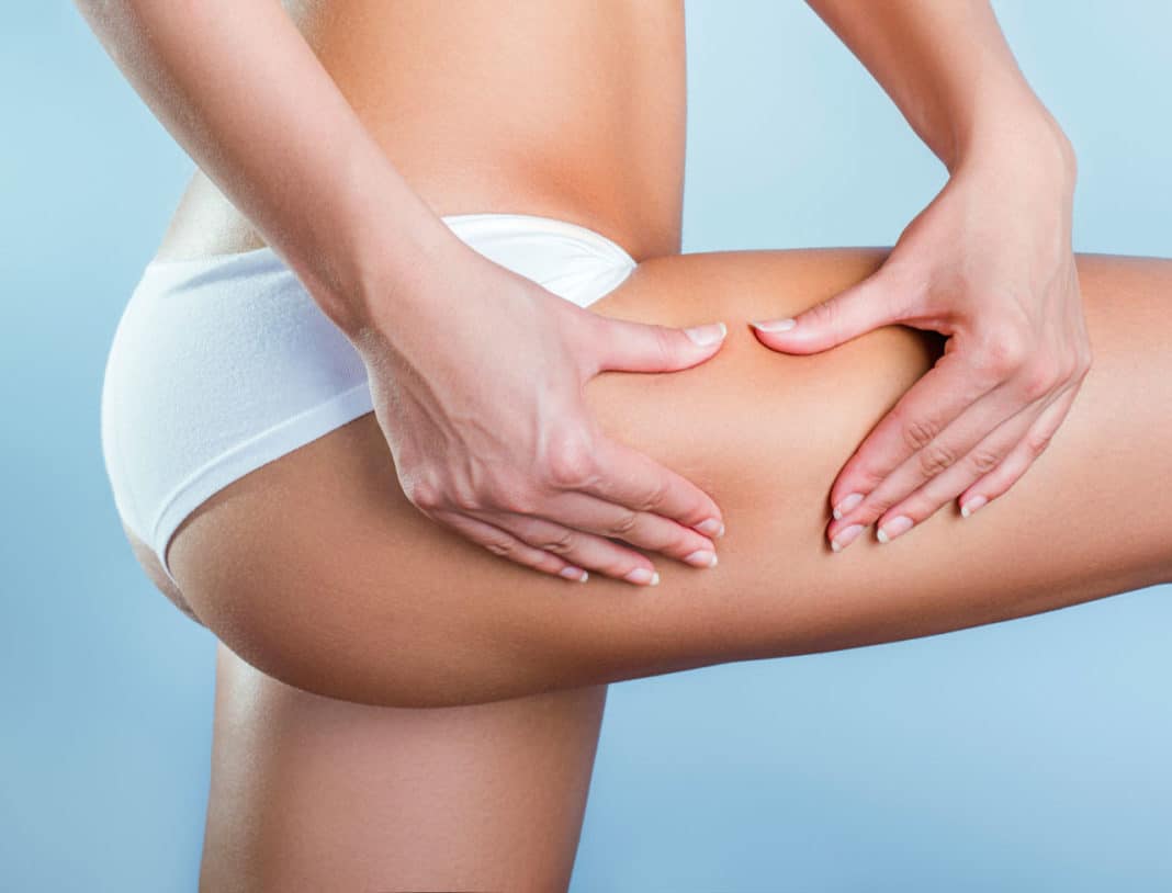 freddo-cellulite-strategie