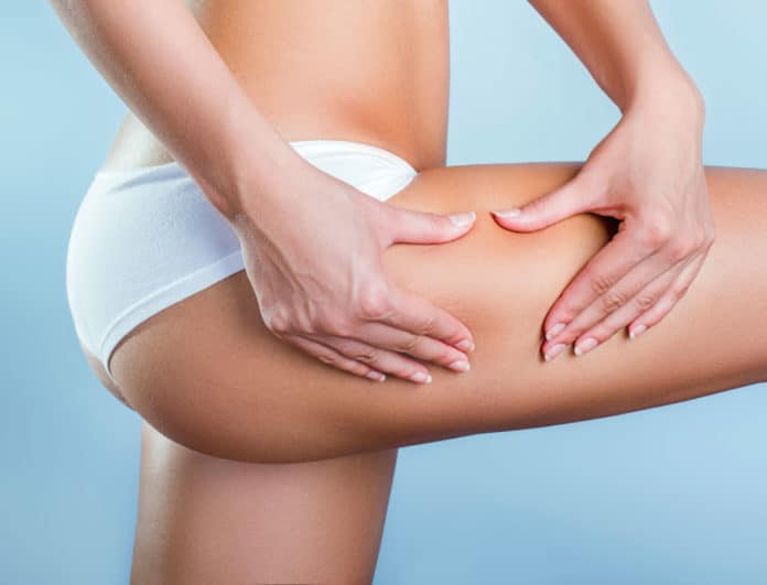 freddo-cellulite-strategie freddo-cellulite-strategie