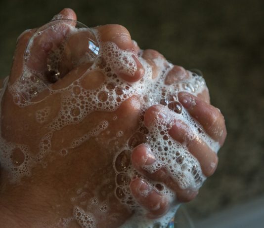 rimedi-naturali-se-ti-lavi-troppo-spesso-le-mani