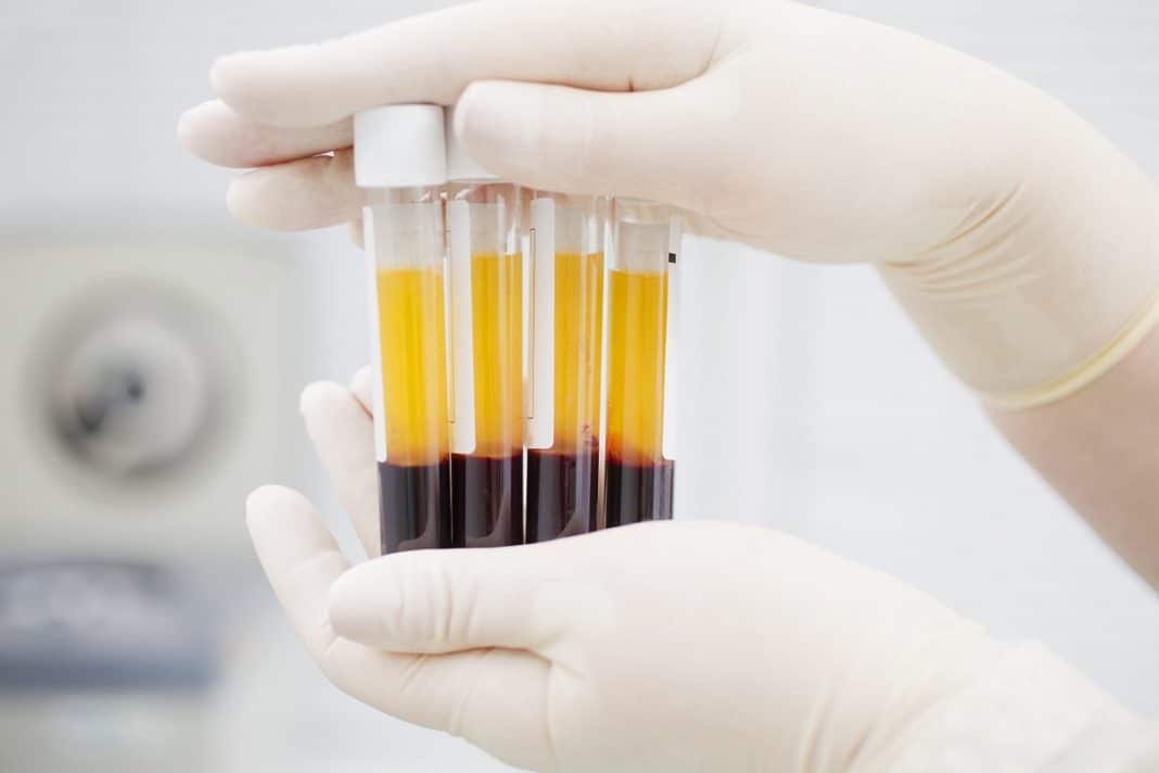 sangue prp sangue prp