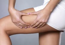 smothie cellulite