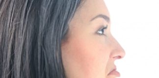Dimpleplasty fossette chirurgia