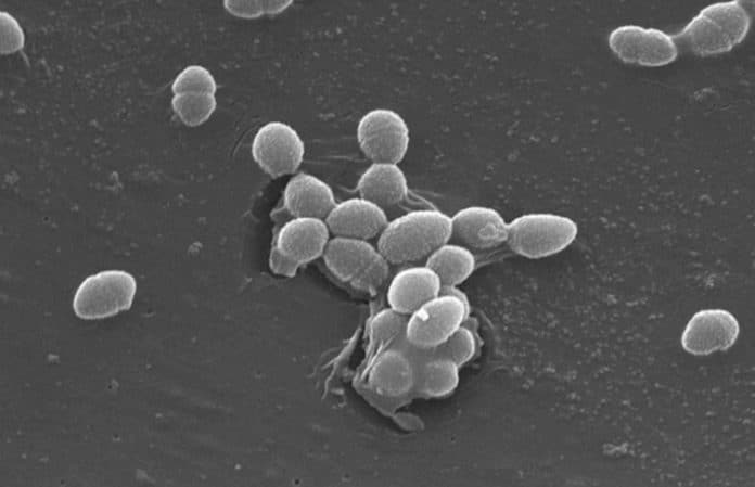 Enterococcus faecalis Enterococcus faecalis