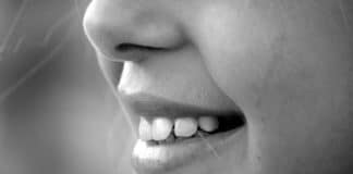 denti bianchi