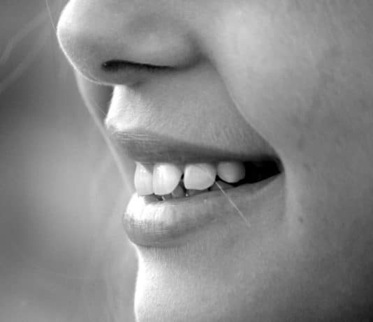 denti bianchi
