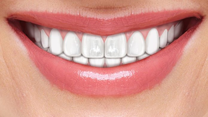 implantologia dentale implantologia dentale