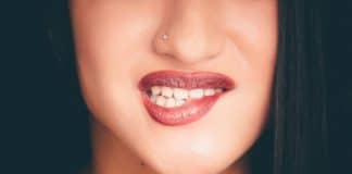 tartaro denti