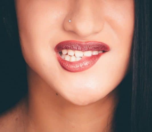 tartaro denti