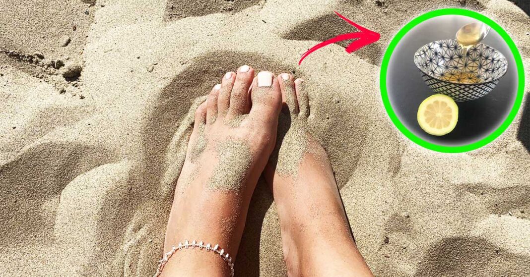 piedi-screpolati-spiaggia