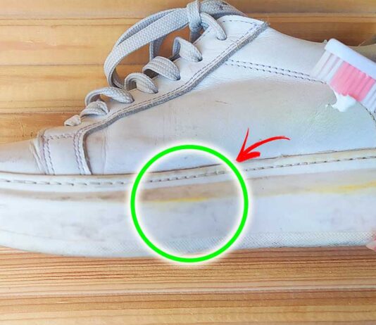 Come Togliere Il Giallo Dalle Scarpe