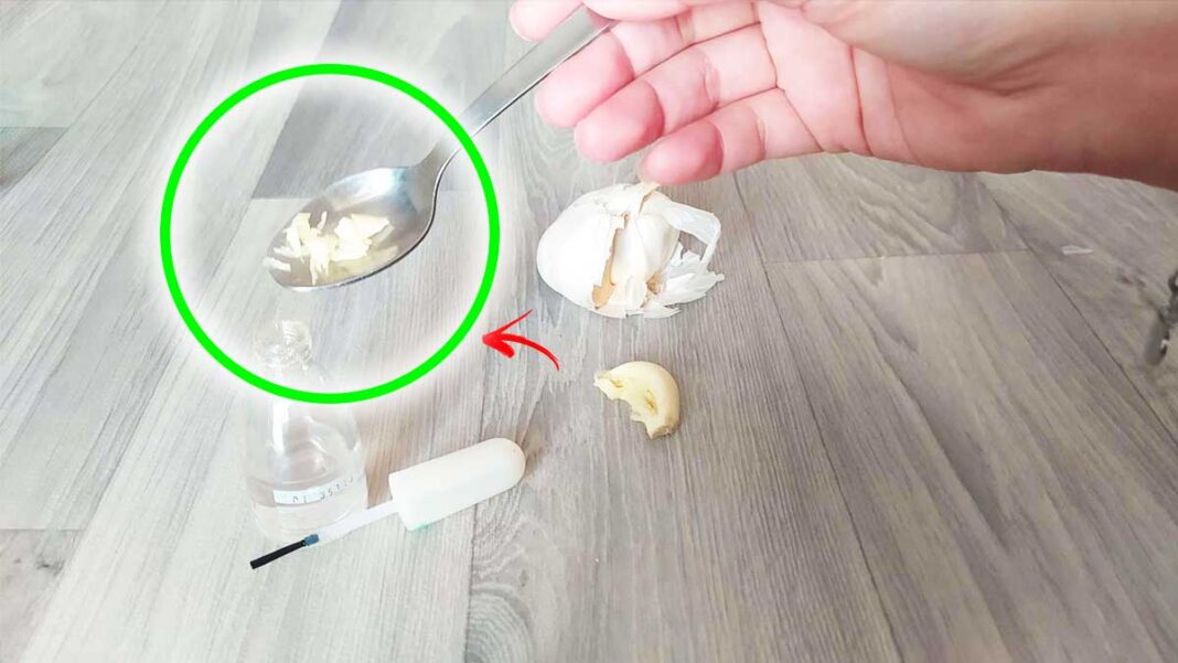 aglio-per-rinforzare-unghie