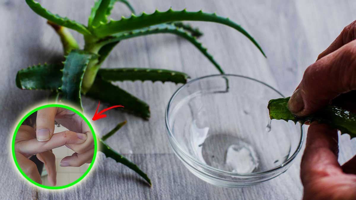 Come fare gli impacchi naturali contro le ragadi!