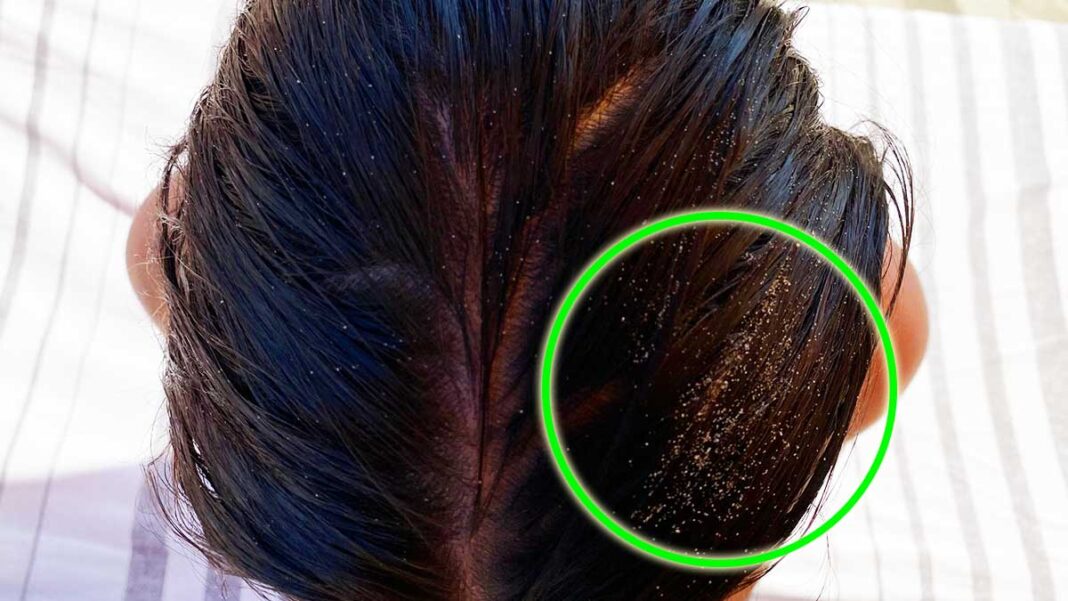come-togliere-sabbia-capelli