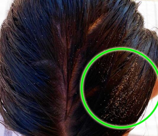 come-togliere-sabbia-capelli