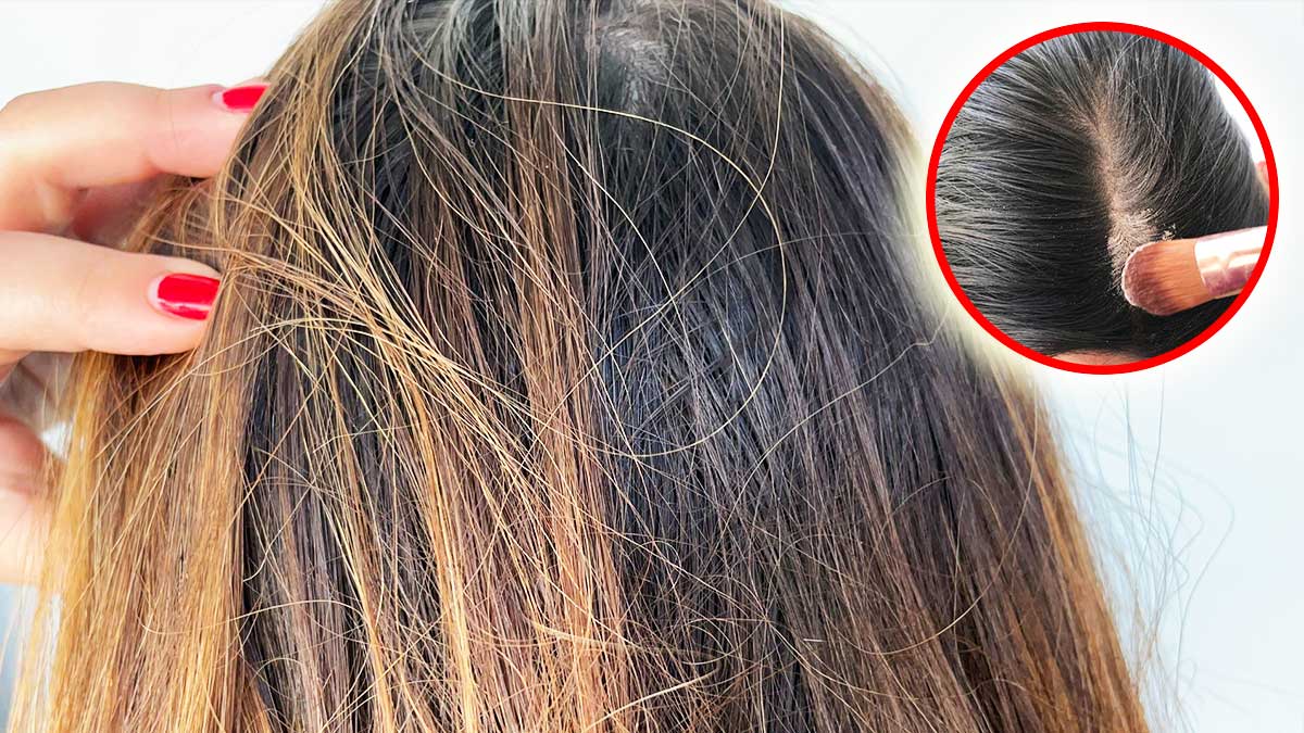 Come non far sudare testa e capelli d’estate?