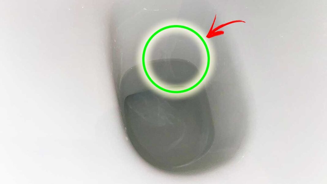anello-calcare-wc