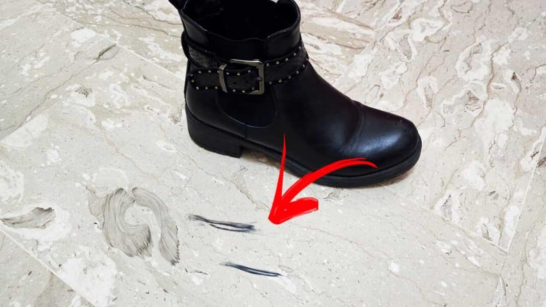 segni-scarpe-rimedi