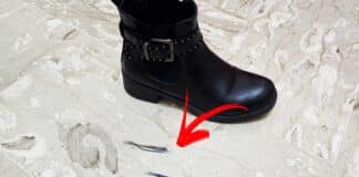 segni-scarpe-rimedi