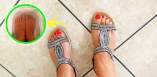 come-ammorbidire-piedi-quando-indossi-sandali
