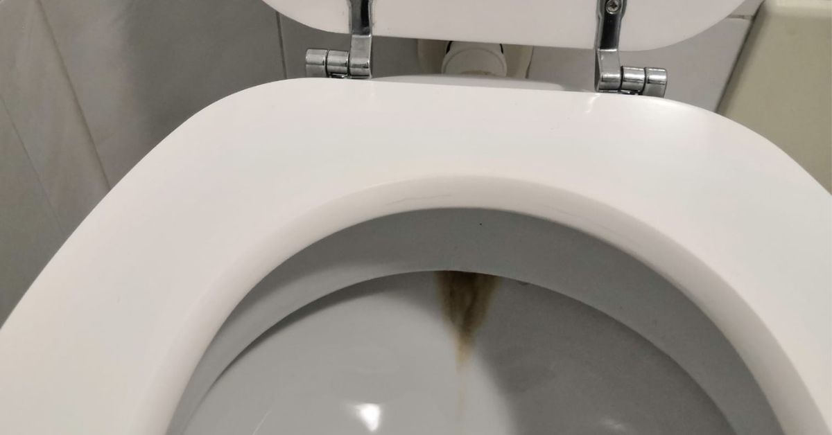 Il metodo per sciogliere le incrostazioni gialle nascoste nel water Il metodo per sciogliere le incrostazioni gialle nascoste nel water