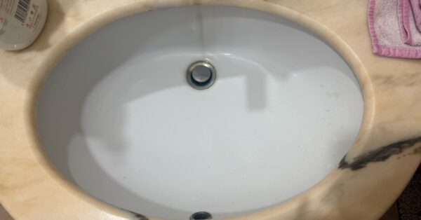 Il lavandino ha una patina ruvida anche quando sembra perfettamente bianco